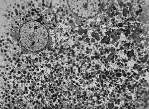 F,3m. | giant cell hepatitis F,3m. | giant cell hepatitis